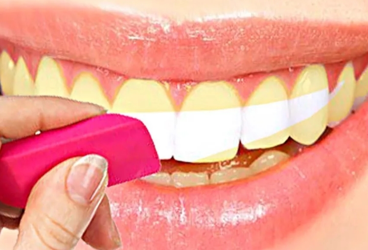 Топ десять способов отбелить зубы в домашних условиях