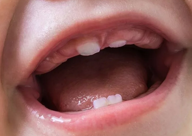 Почему нужно вовремя проверять зубы у ребенка